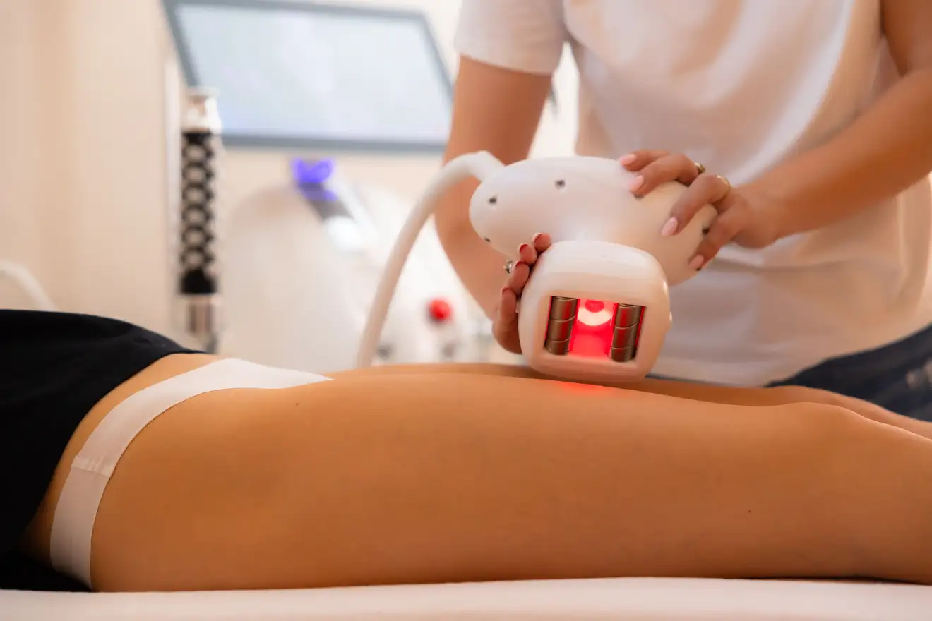 Velashape procedúra