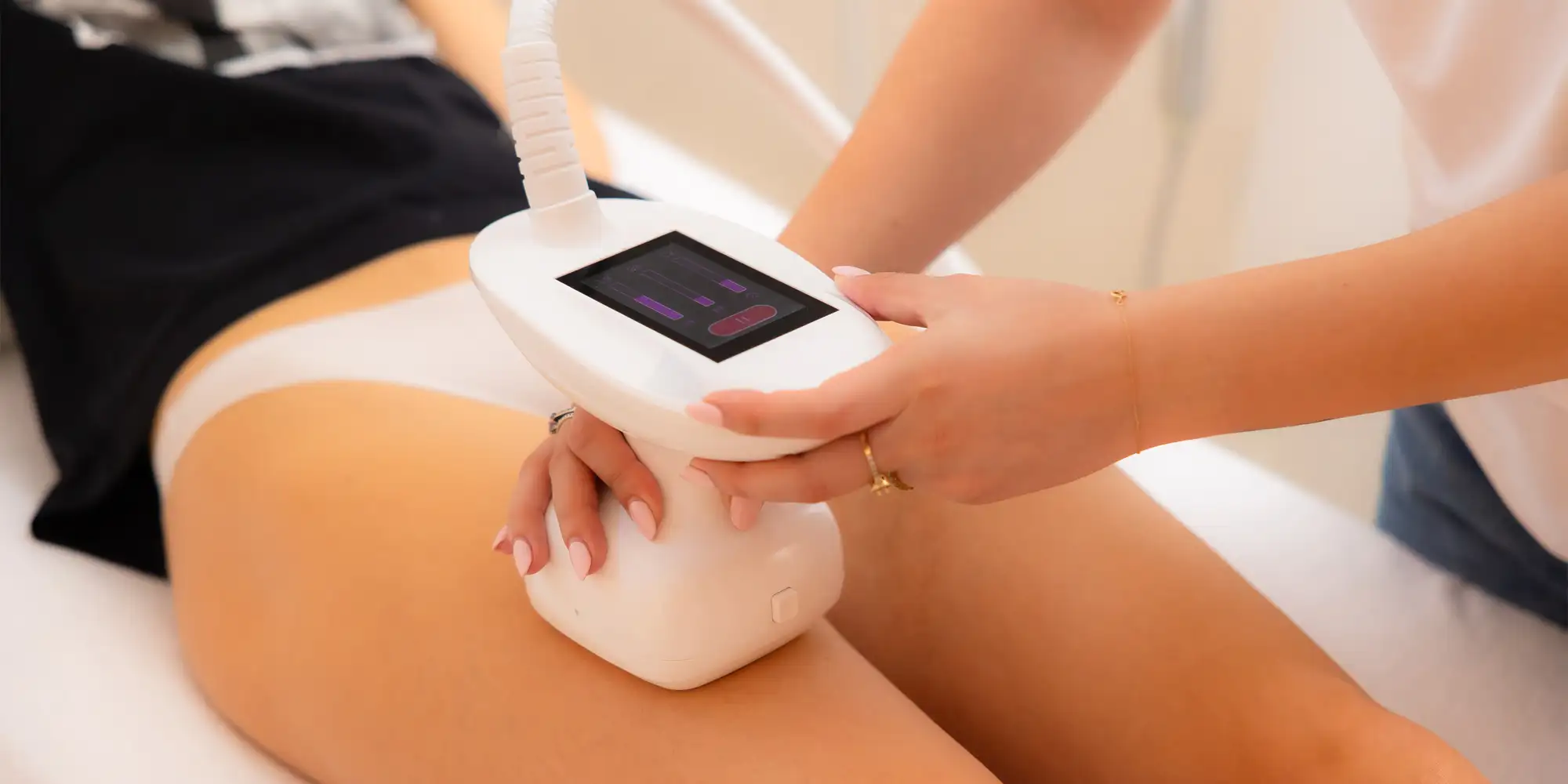 Velashape ošetrenie stehien